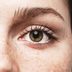 Yes, Eye Freckles Are a Thingâ€”and This Is What They Reveal About Your Health