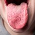 9 Health Clues Hiding Right on Your Tongue